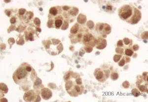 Immunohistochemistry (Formalin/PFA-fixed paraffin-embedded sections) - Anti-Survivin antibody (AB469)