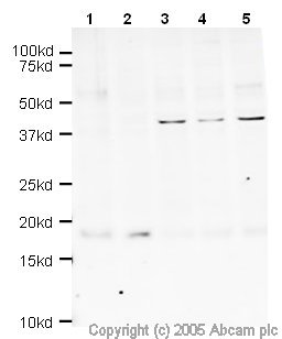 Western blot - Anti-Survivin antibody (AB469), expandable thumbnail