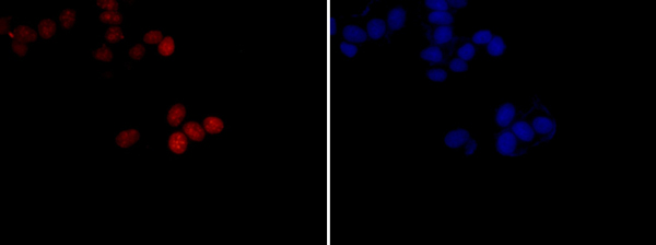 Immunocytochemistry/ Immunofluorescence - Anti-Survivin antibody [EP2880Y] (ab76424), expandable thumbnail