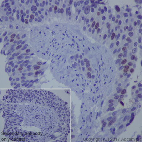 Immunohistochemistry (Formalin/PFA-fixed paraffin-embedded sections) - Anti-Survivin antibody [EP2880Y] (AB76424), expandable thumbnail