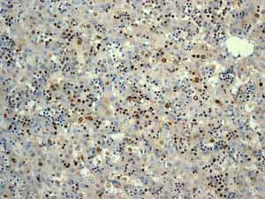 Immunohistochemistry (Formalin/PFA-fixed paraffin-embedded sections) - Anti-Survivin antibody [EP2880Y] (ab76424), expandable thumbnail