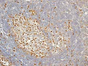 Immunohistochemistry (Formalin/PFA-fixed paraffin-embedded sections) - Anti-Survivin antibody [EP2880Y] (ab76424), expandable thumbnail