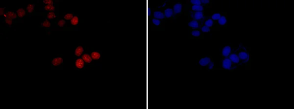 Immunocytochemistry/ Immunofluorescence - Anti-Survivin antibody [EP2880Y] - BSA and Azide free (AB192675)