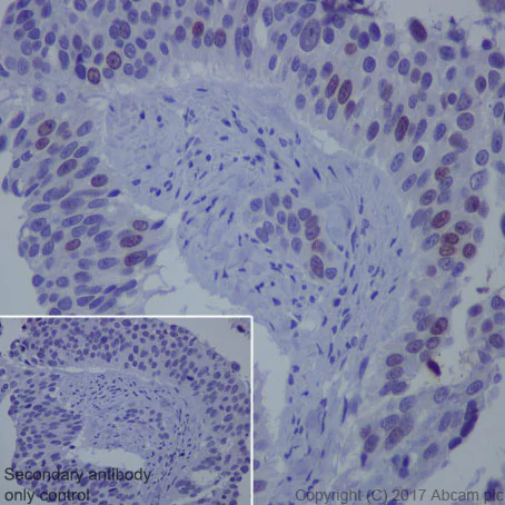 Immunohistochemistry (Formalin/PFA-fixed paraffin-embedded sections) - Anti-Survivin antibody [EP2880Y] - BSA and Azide free (AB192675)
