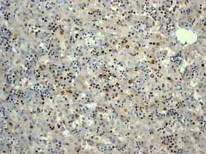 Immunohistochemistry (Formalin/PFA-fixed paraffin-embedded sections) - Anti-Survivin antibody [EP2880Y] - BSA and Azide free (AB192675)