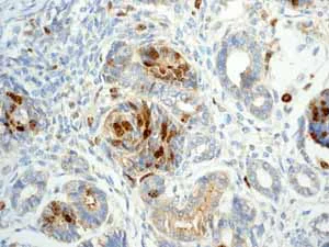 Immunohistochemistry (Formalin/PFA-fixed paraffin-embedded sections) - Anti-Survivin antibody [EP2880Y] - BSA and Azide free (AB192675)