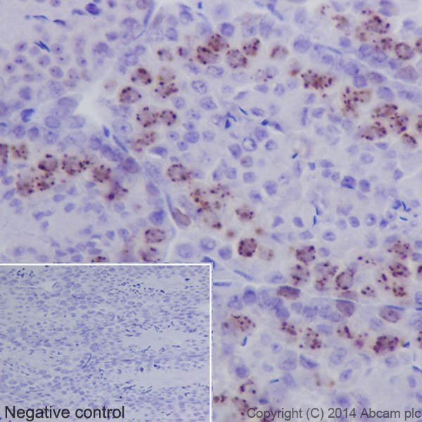 Immunohistochemistry (Formalin/PFA-fixed paraffin-embedded sections) - Anti-Survivin antibody [EPR17358] (AB182132)