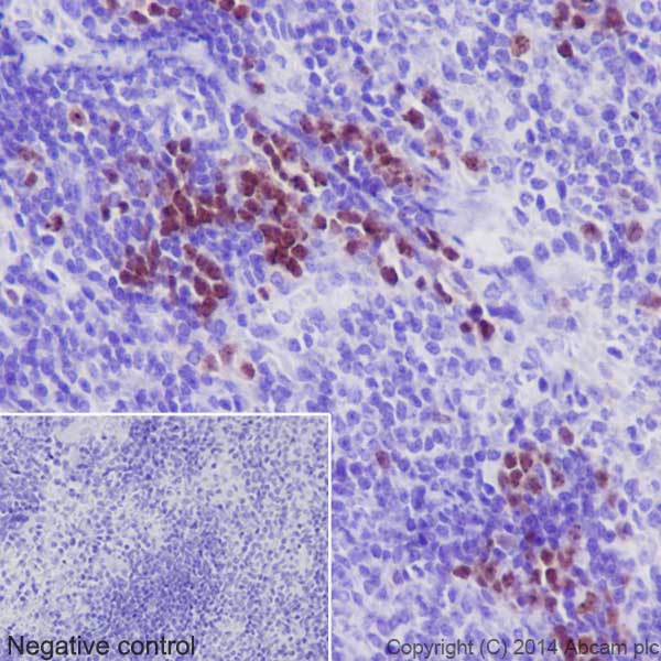 Immunohistochemistry (Formalin/PFA-fixed paraffin-embedded sections) - Anti-Survivin antibody [EPR17358] (AB182132)