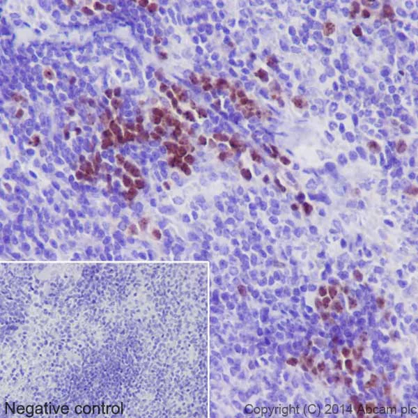 Immunohistochemistry (Formalin/PFA-fixed paraffin-embedded sections) - Anti-Survivin antibody [EPR17358] (AB182132)