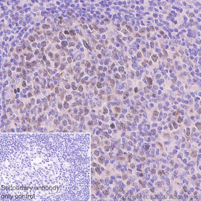 Immunohistochemistry (Formalin/PFA-fixed paraffin-embedded sections) - Anti-Survivin antibody [EPR2675] (AB134170)