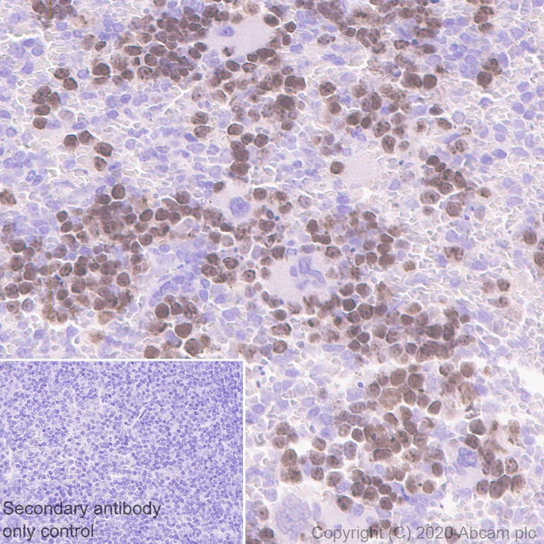 Immunohistochemistry (Formalin/PFA-fixed paraffin-embedded sections) - Anti-Survivin antibody [EPR2675] - BSA and Azide free (AB167450)
