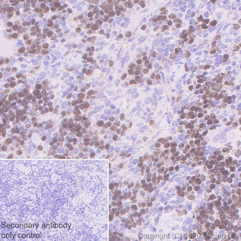Immunohistochemistry (Formalin/PFA-fixed paraffin-embedded sections) - Anti-Survivin antibody [EPR2675] - BSA and Azide free (AB167450)