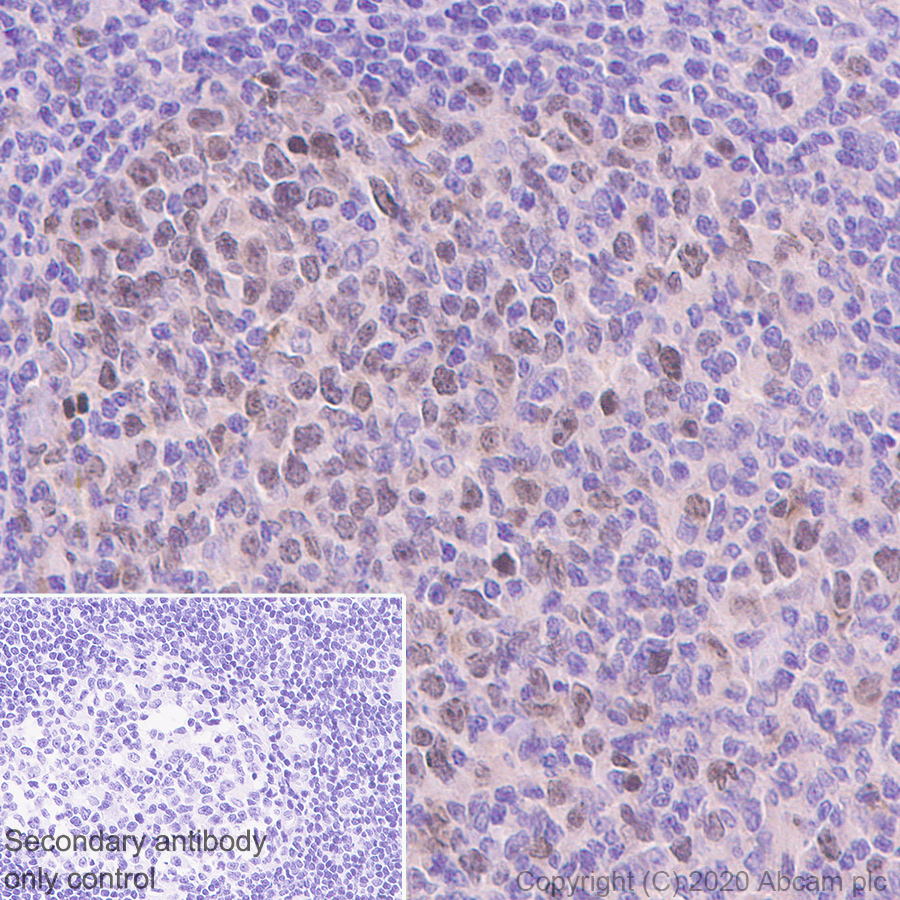 Immunohistochemistry (Formalin/PFA-fixed paraffin-embedded sections) - Anti-Survivin antibody [EPR2675] - BSA and Azide free (AB167450)