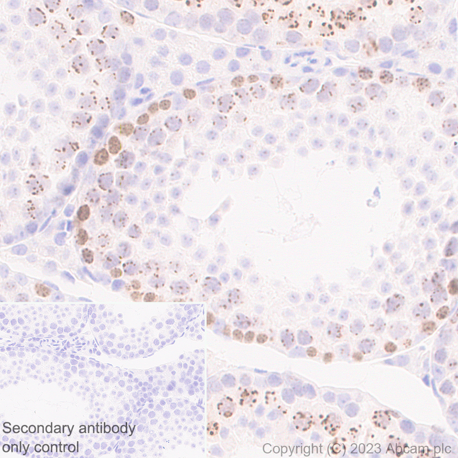 Immunohistochemistry (Formalin/PFA-fixed paraffin-embedded sections) - Anti-Survivin antibody [RM1086] (ab316022), expandable thumbnail