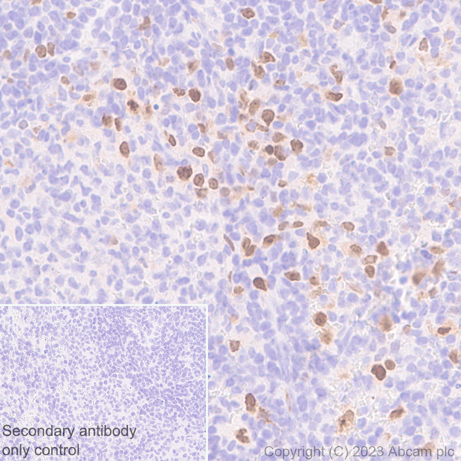 Immunohistochemistry (Formalin/PFA-fixed paraffin-embedded sections) - Anti-Survivin antibody [RM1086] (ab316022), expandable thumbnail
