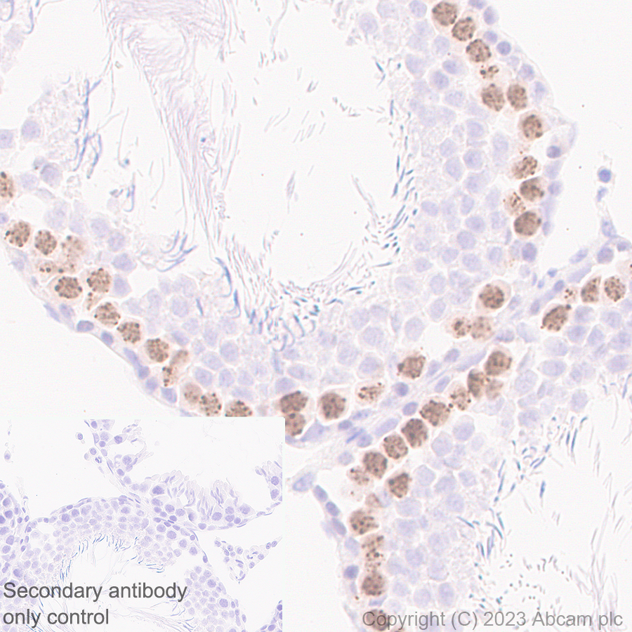 Immunohistochemistry (Formalin/PFA-fixed paraffin-embedded sections) - Anti-Survivin antibody [RM1086] (AB316022), expandable thumbnail