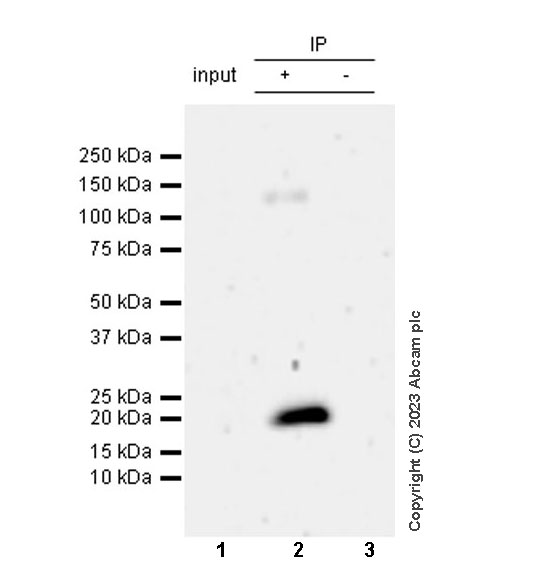 Immunoprecipitation - Anti-Survivin antibody [RM1086] (ab316022), expandable thumbnail