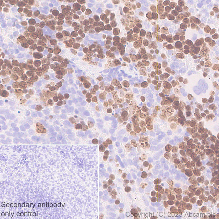 Immunohistochemistry (Formalin/PFA-fixed paraffin-embedded sections) - Anti-Survivin antibody [RM1086] - BSA and Azide free (AB316023)