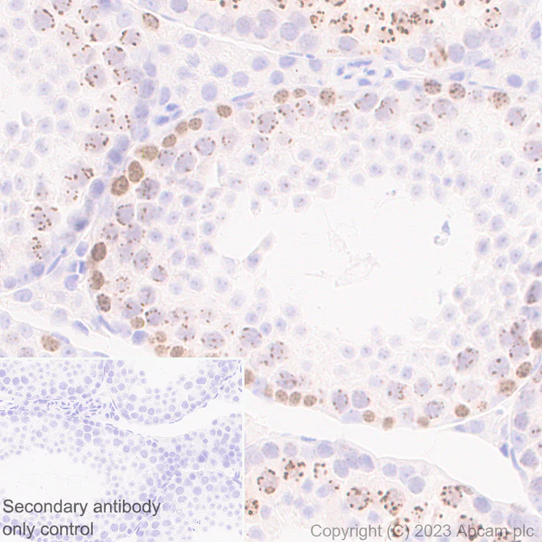 Immunohistochemistry (Formalin/PFA-fixed paraffin-embedded sections) - Anti-Survivin antibody [RM1086] - BSA and Azide free (AB316023)