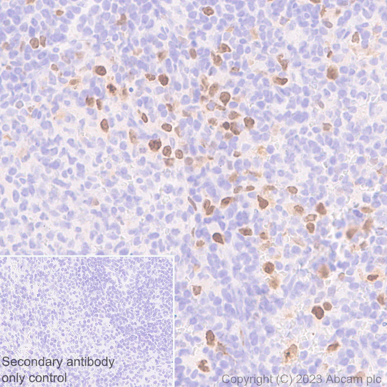 Immunohistochemistry (Formalin/PFA-fixed paraffin-embedded sections) - Anti-Survivin antibody [RM1086] - BSA and Azide free (AB316023)