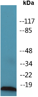Western blot - Anti-Survivin (phospho T34) antibody (AB138653), expandable thumbnail