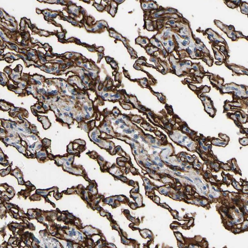 Immunohistochemistry (Formalin/PFA-fixed paraffin-embedded sections) - Anti-SUSD2 antibody (AB121214), expandable thumbnail