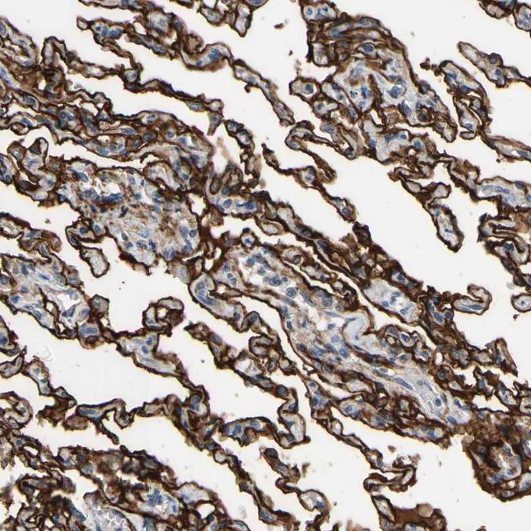 Immunohistochemistry (Formalin/PFA-fixed paraffin-embedded sections) - Anti-SUSD2 antibody (AB121214)
