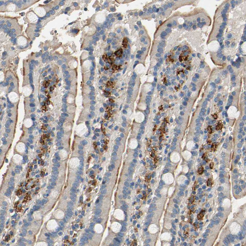 Immunohistochemistry (Formalin/PFA-fixed paraffin-embedded sections) - Anti-SUSD2 antibody (AB121214), expandable thumbnail