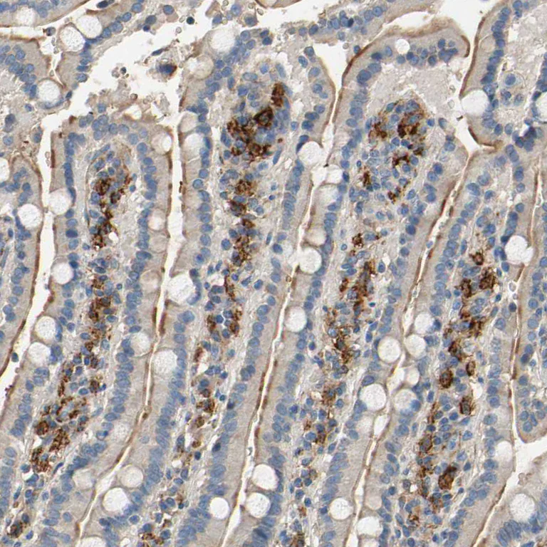 Immunohistochemistry (Formalin/PFA-fixed paraffin-embedded sections) - Anti-SUSD2 antibody (AB121214)