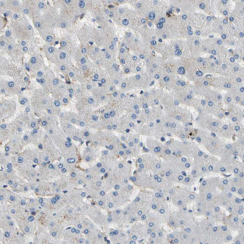 Immunohistochemistry (Formalin/PFA-fixed paraffin-embedded sections) - Anti-SUSD2 antibody (AB121214), expandable thumbnail