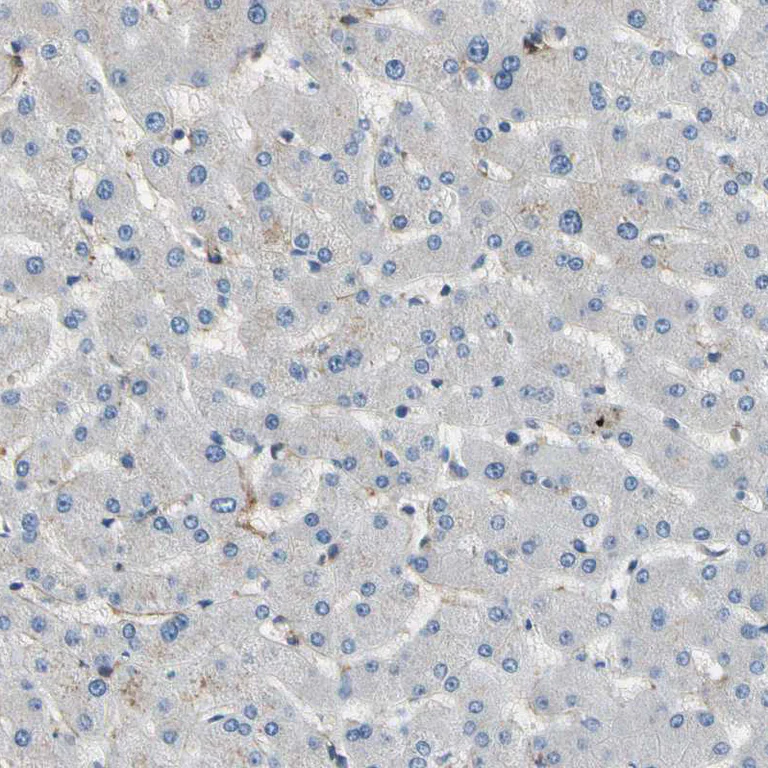 Immunohistochemistry (Formalin/PFA-fixed paraffin-embedded sections) - Anti-SUSD2 antibody (AB121214)