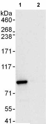 Immunoprecipitation - Anti-SUV3L1 antibody (AB176854), expandable thumbnail