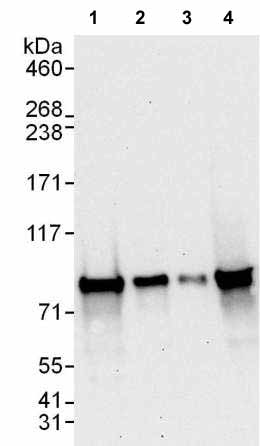 Western blot - Anti-SUV3L1 antibody (AB176854), expandable thumbnail