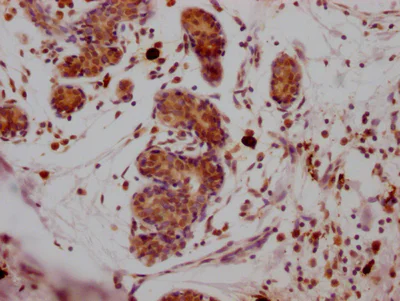 Immunohistochemistry (Formalin/PFA-fixed paraffin-embedded sections) - Anti-SUZ12 antibody [1B10] (AB314166)