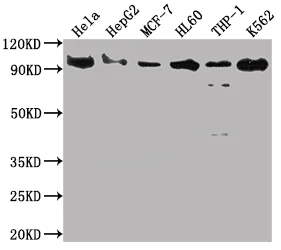 Western blot - Anti-SUZ12 antibody [1B10] (AB314166)