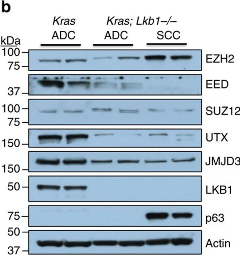 Western blot - Anti-SUZ12 antibody (AB12073)