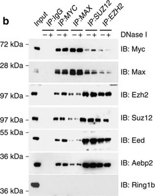 Western blot - Anti-SUZ12 antibody (AB12073)