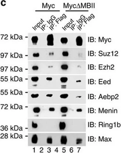 Western blot - Anti-SUZ12 antibody (AB12073)