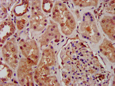 Immunohistochemistry (Formalin/PFA-fixed paraffin-embedded sections) - Anti-SUZ12 antibody (AB236322)