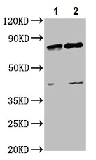 Western blot - Anti-SUZ12 antibody (AB236322)