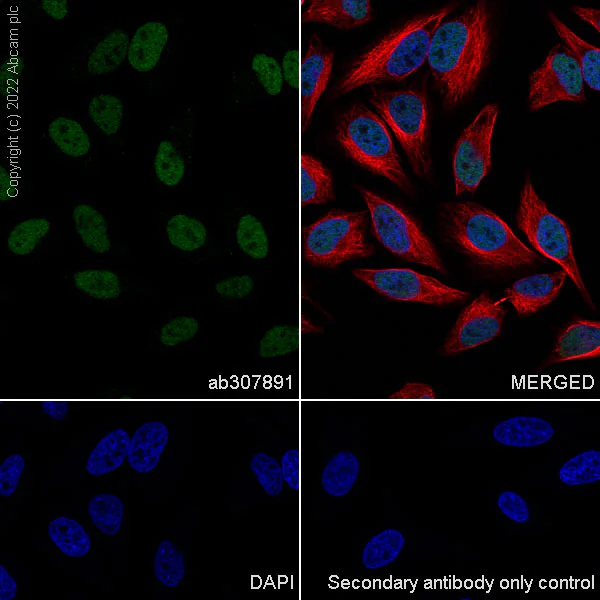Immunocytochemistry/ Immunofluorescence - Anti-SUZ12 antibody [EPR26230-82] (AB307891)