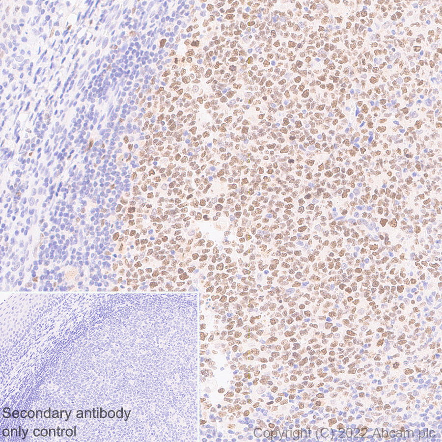 Immunohistochemistry (Formalin/PFA-fixed paraffin-embedded sections) - Anti-SUZ12 antibody [EPR26230-82] (AB307891)
