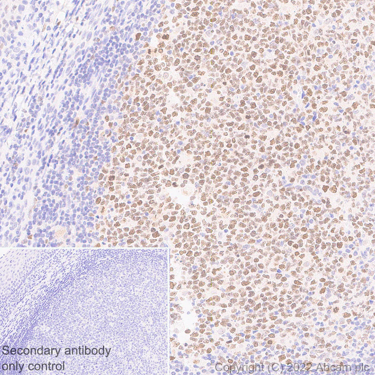 Immunohistochemistry (Formalin/PFA-fixed paraffin-embedded sections) - Anti-SUZ12 antibody [EPR26230-82] - BSA and Azide free (AB307892)