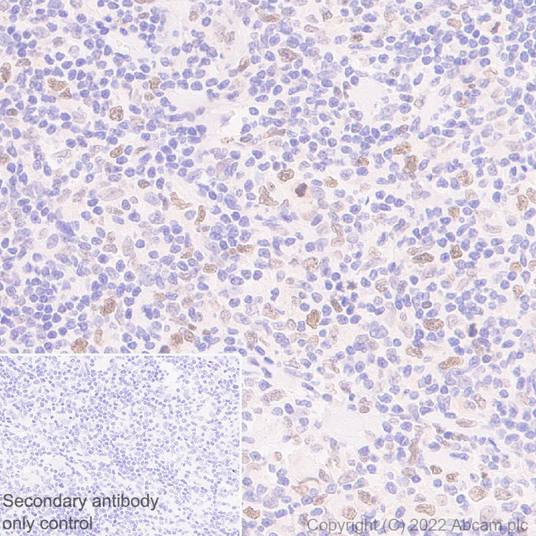 Immunohistochemistry (Formalin/PFA-fixed paraffin-embedded sections) - Anti-SUZ12 antibody [EPR26230-82] - BSA and Azide free (AB307892)