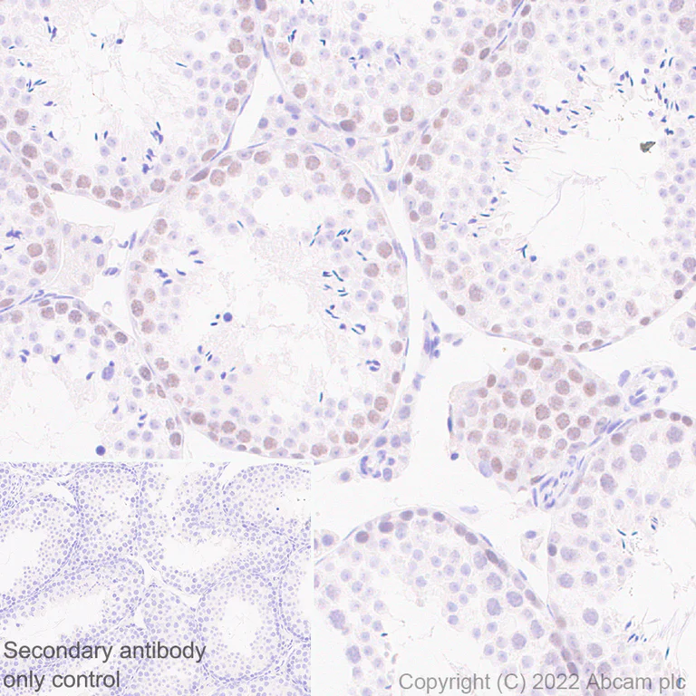 Immunohistochemistry (Formalin/PFA-fixed paraffin-embedded sections) - Anti-SUZ12 antibody [EPR26230-82] - BSA and Azide free (AB307892)