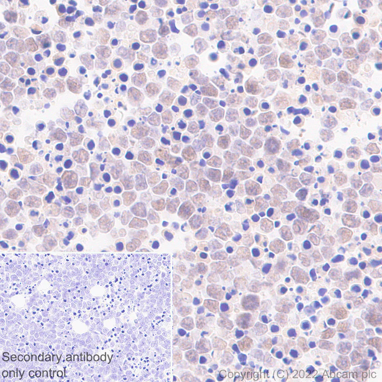 Immunohistochemistry (Formalin/PFA-fixed paraffin-embedded sections) - Anti-SUZ12 antibody [EPR26230-82] - BSA and Azide free (AB307892)