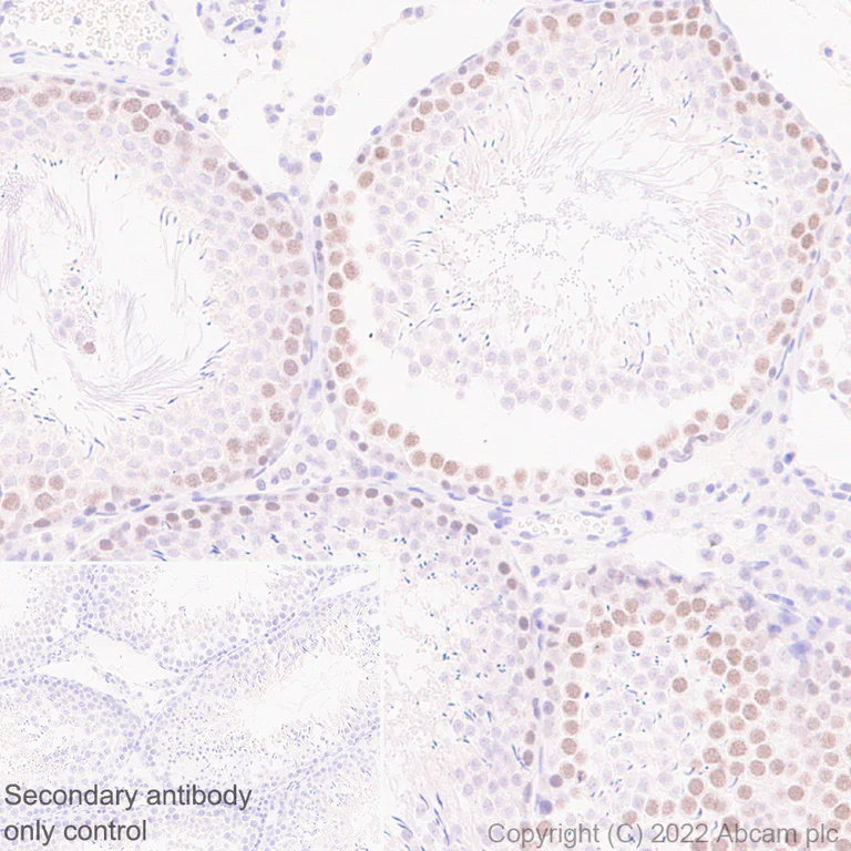Immunohistochemistry (Formalin/PFA-fixed paraffin-embedded sections) - Anti-SUZ12 antibody [EPR26230-82] - BSA and Azide free (AB307892)