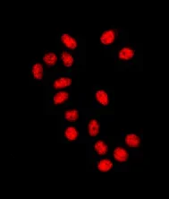 Immunocytochemistry/ Immunofluorescence - Anti-SUZ12 antibody [EPR5234(N)] - ChIP Grade (AB175187)