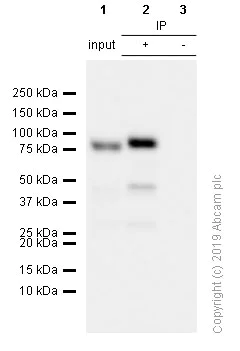 Immunoprecipitation - Anti-SUZ12 antibody [EPR5234(N)] - ChIP Grade (AB175187)
