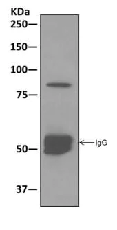 Immunoprecipitation - Anti-SUZ12 antibody [EPR5234(N)] - ChIP Grade (AB175187)